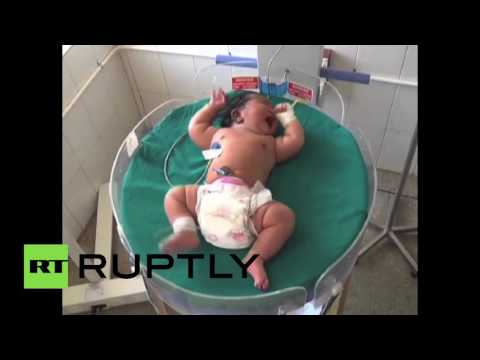 ولادة أثقل طفلة في العالم في الهند