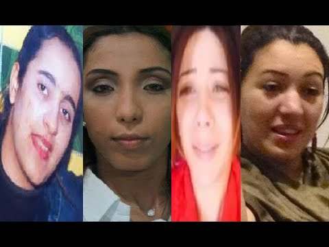 شاهد  نجمات مغربيات قبل وبعد إجراء عمليات التجميل