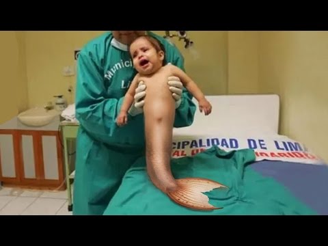 شاهد طفل الشيخوخة المبكرة أغرب 8 صغار  في العالم