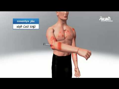 نجلاء فتحي تعالج من الصدفية بدواء جديد