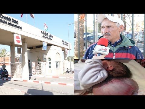 شاهد أب الرضيعة ذات الرأسين يتحدّث عن حالة ابنته