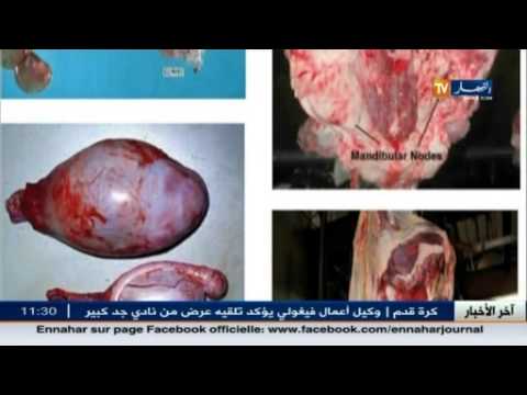 شاهد 16 حالة وإصابة بوباء الحمى المالطية في ولاية البويرة