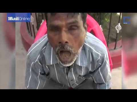 بالفيديو تعرف على الرجل الذي أدمن تناول الحجارة