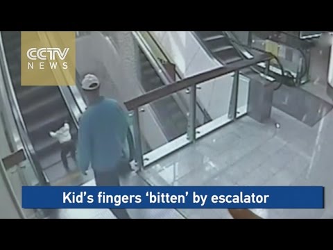 سلم كهربائي يقطع أصابع رضيعة صينية